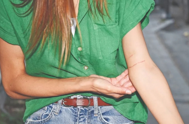 Jessica May kedisini kurtarırken ağaçtan düştü