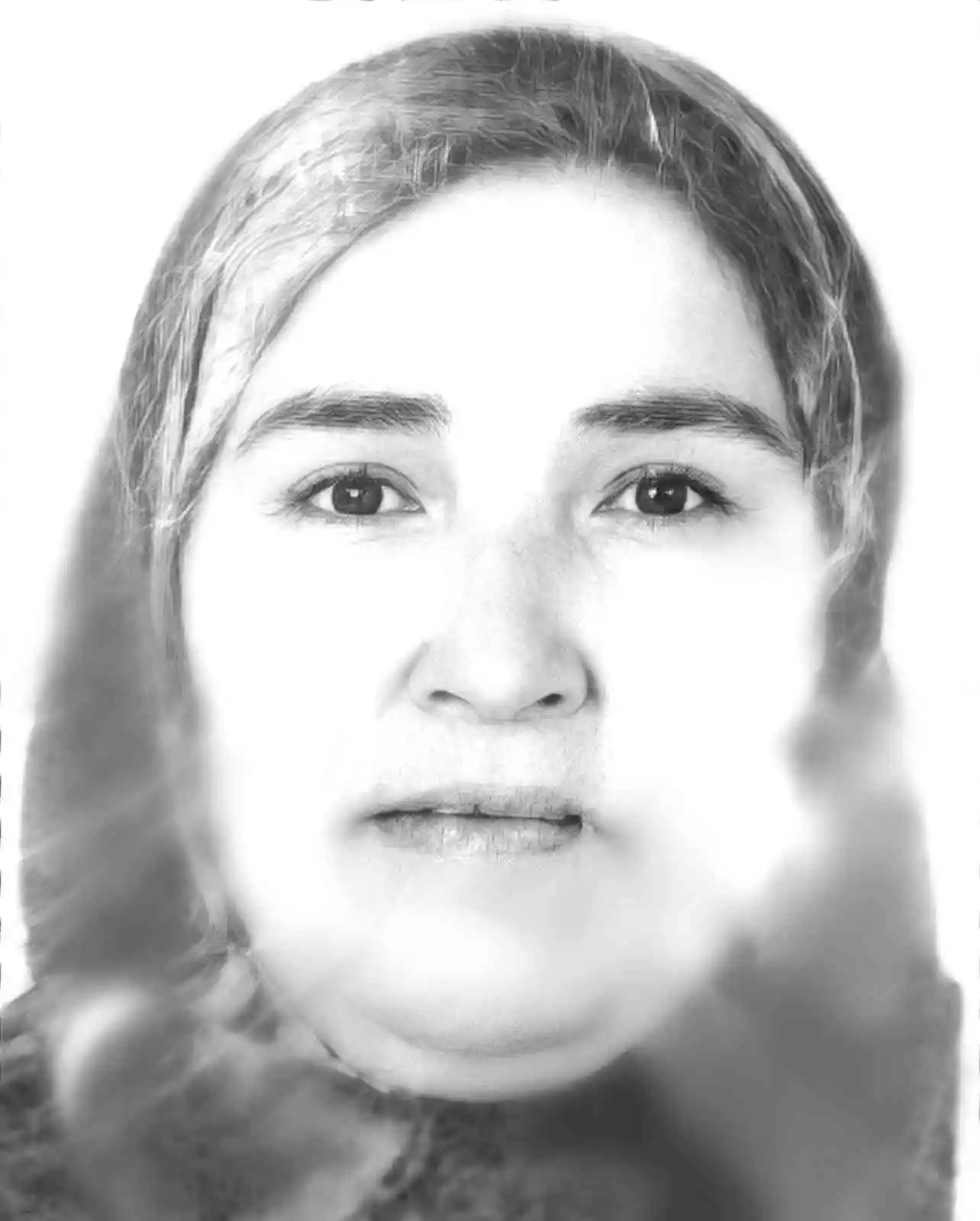 Samsun'daki kazada yaralanan kadın hayatını kaybetti